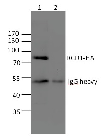RCD1 | Radical cell death 1 in the group Antibodies for Plant/Algal / Developmental Biology / Signal transduction at Agrisera AB (Antibodies for research) (AS12 2602)